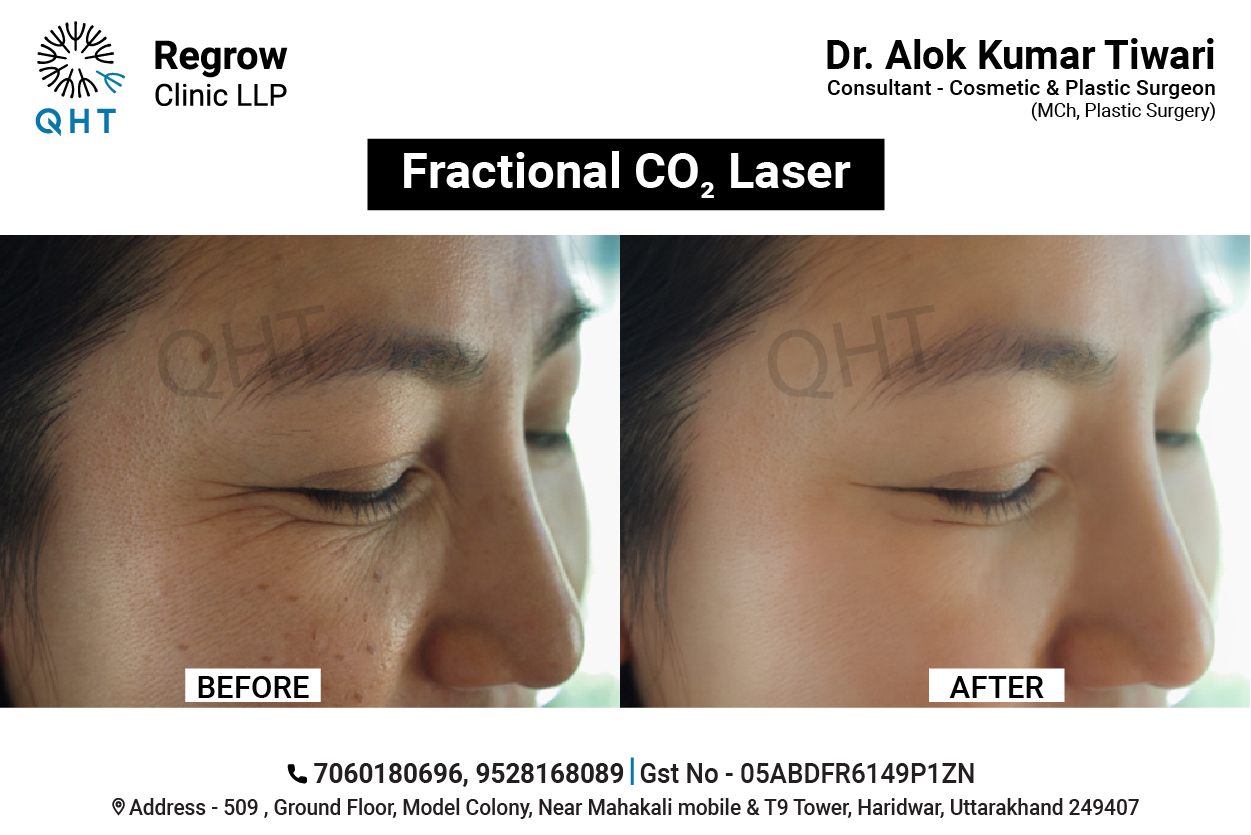 Anti-aging-treatment-qht