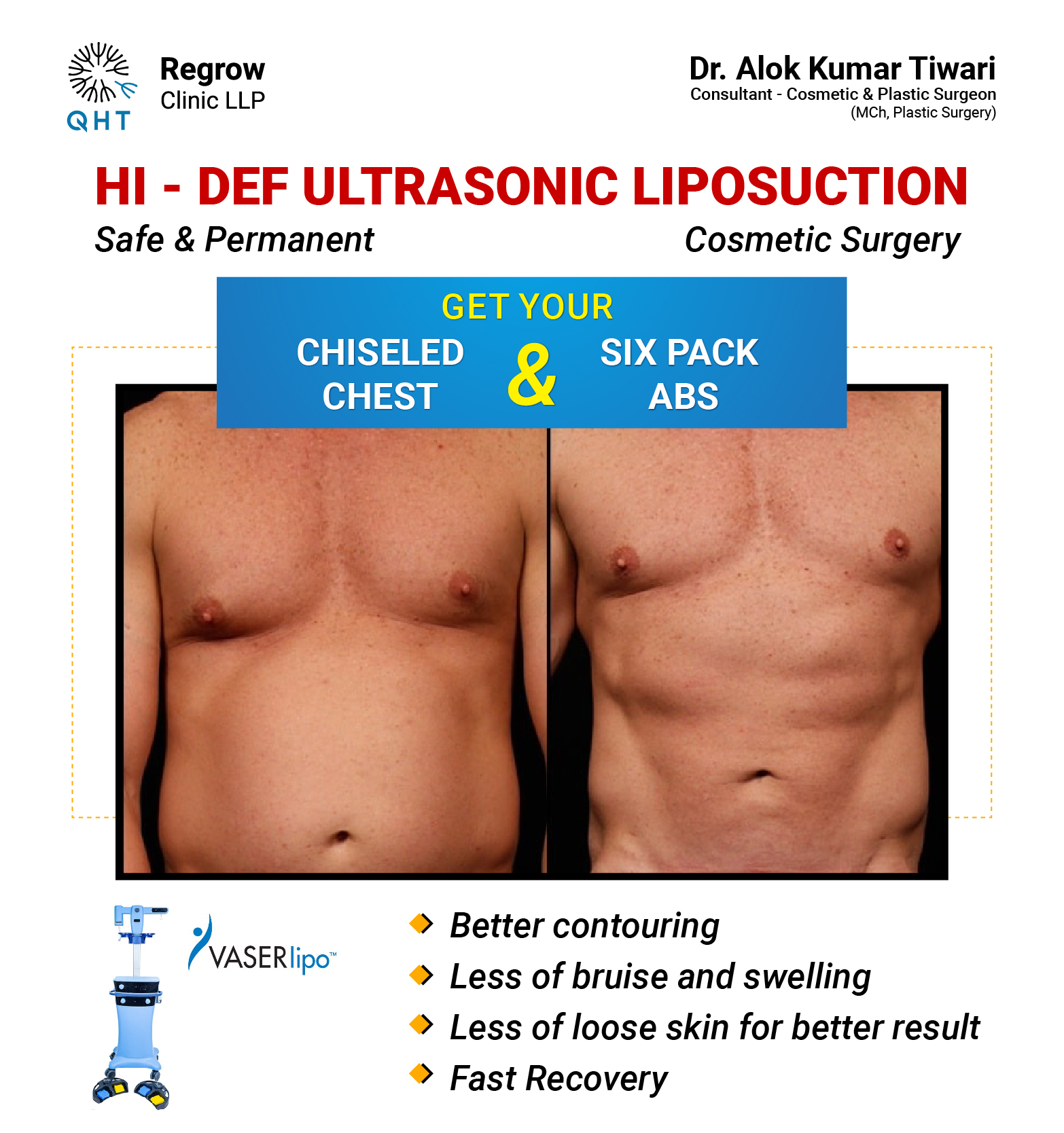 ULTRASONIC-LIPOSUCTION-QHT