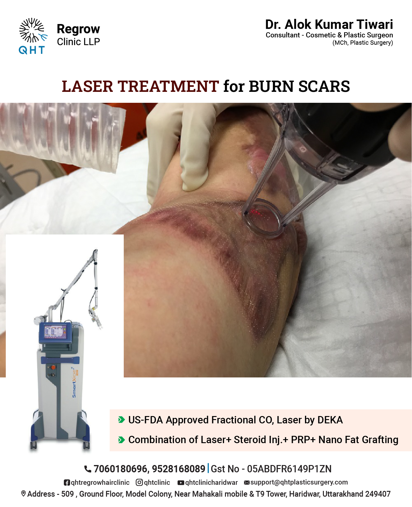 laser-for-burn-scar-qht