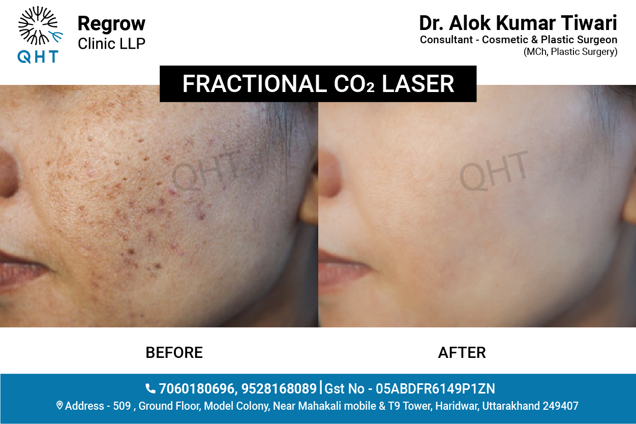 SKIN-REJUVENATION-QHT